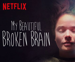 My Beautiful Broken Brain A Netflix Documentary Review   My Beautiful Broken Brain Blog 